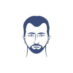 Receding Hairline